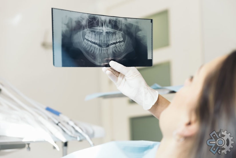 Hasznos tudnivalók a fogászati röntgenekről